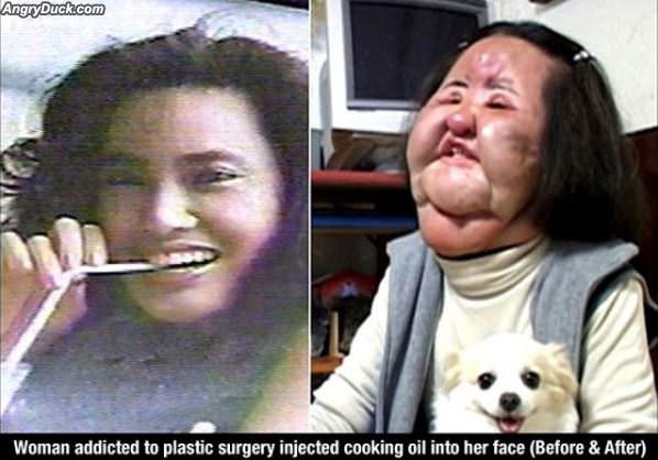 Plastic Surgery Addict