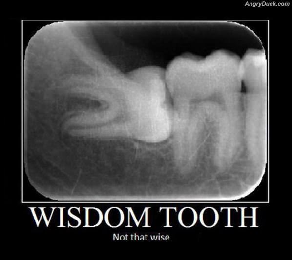 Wisdom Tooth